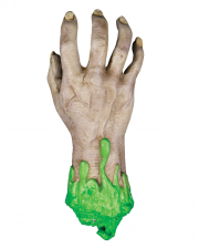 Radioactive Contaminated Severed Hand 