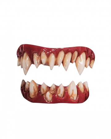 Dental FX Veneers Morlock Teeth 