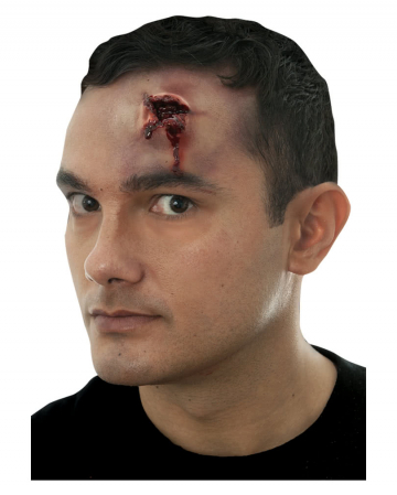 Gunshot wound / 38 Exit 