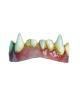 Dental Veneers FX werewolf teeth 